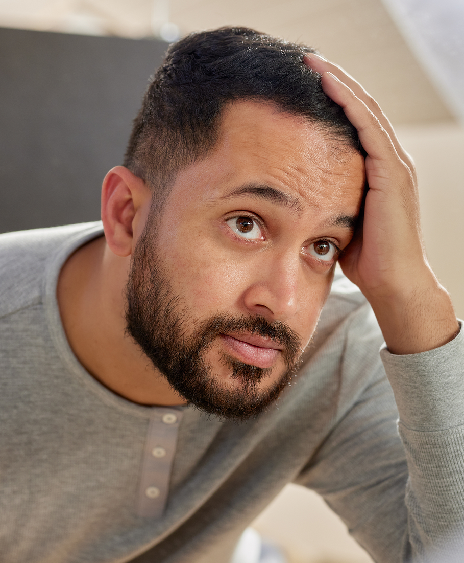 Man with a beard and gray sweater examining his hairline.